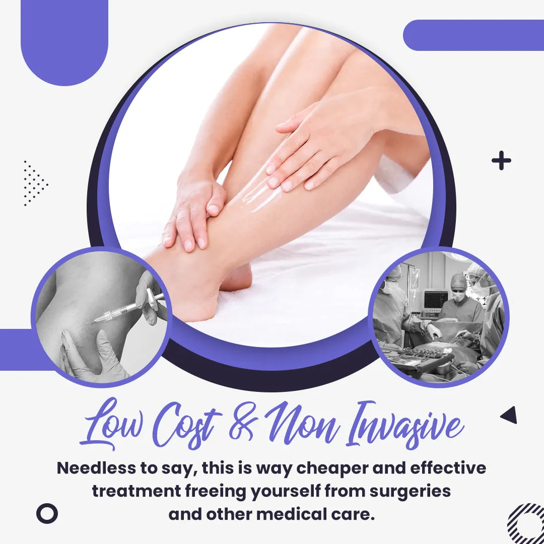 Varicose Veins Relief Cream