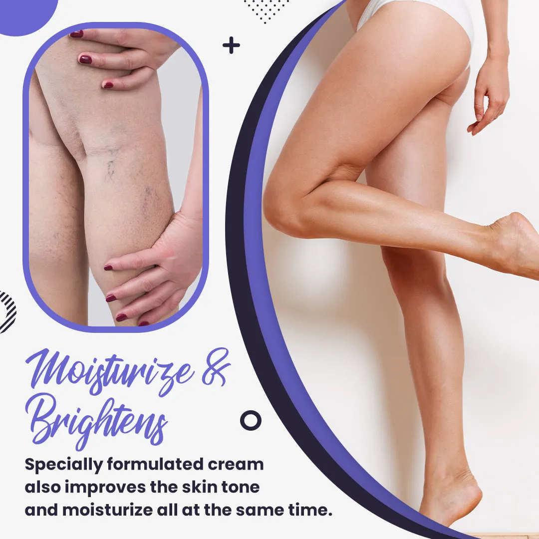 Varicose Veins Relief Cream