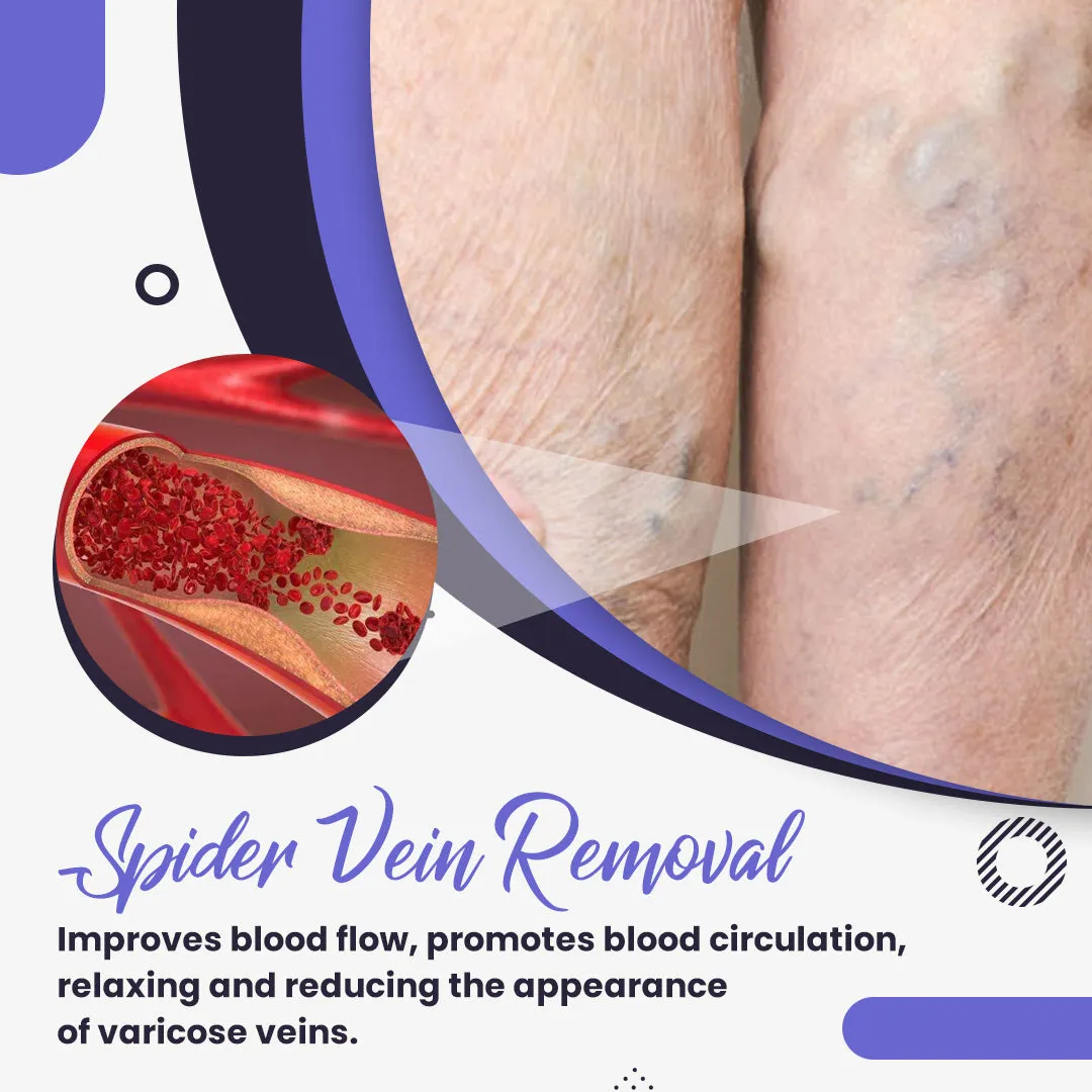 Varicose Veins Relief Cream